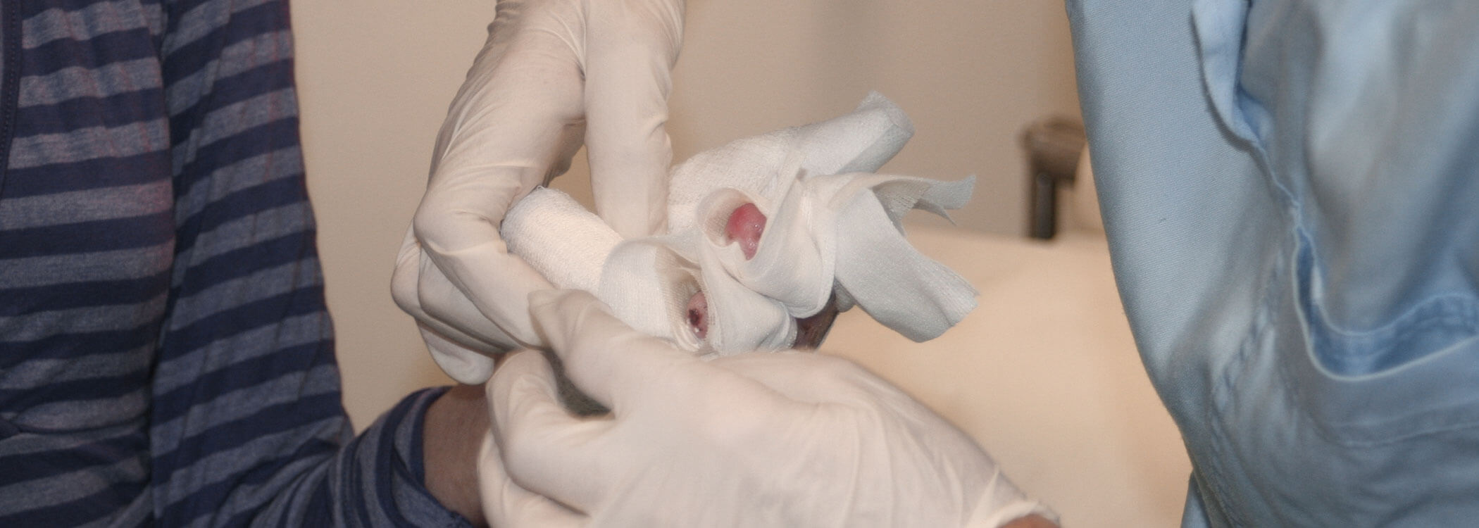 Bendaggio delle mani