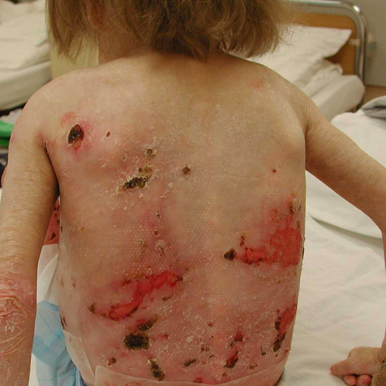 Verletzungen am Rücken