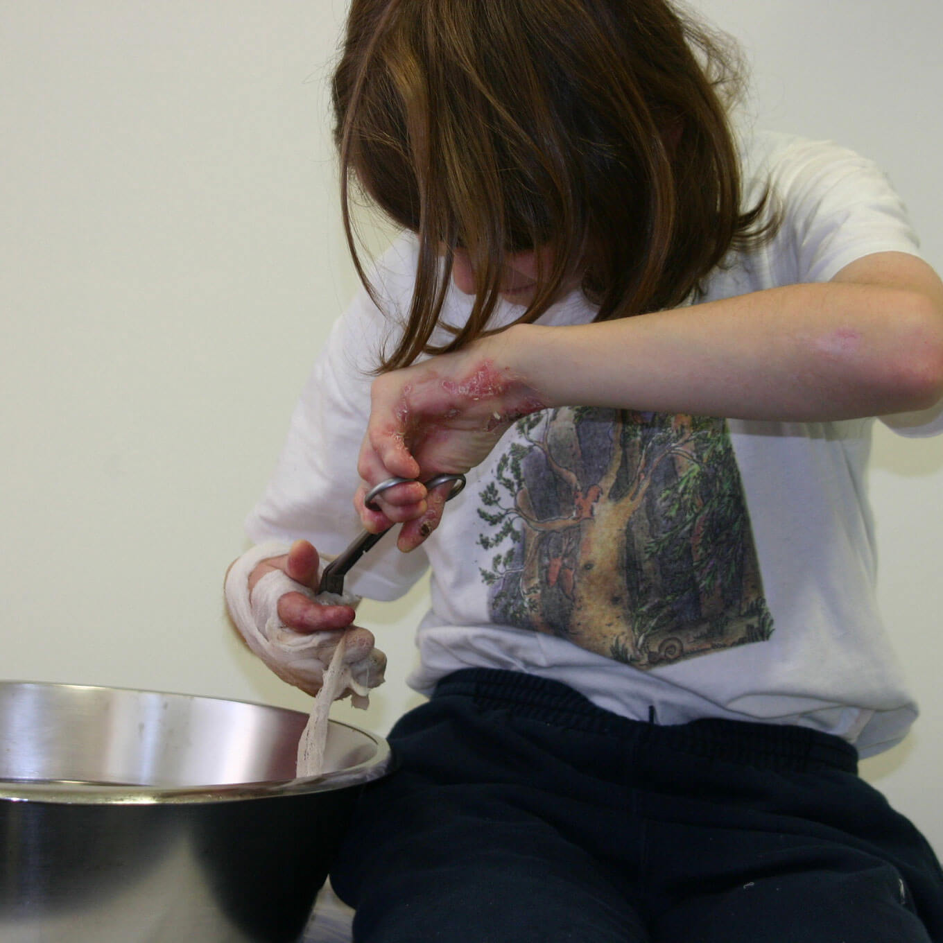 Mädchen verbindet sich selbst